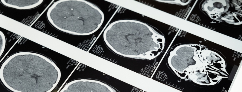 medical scanned images of a brain