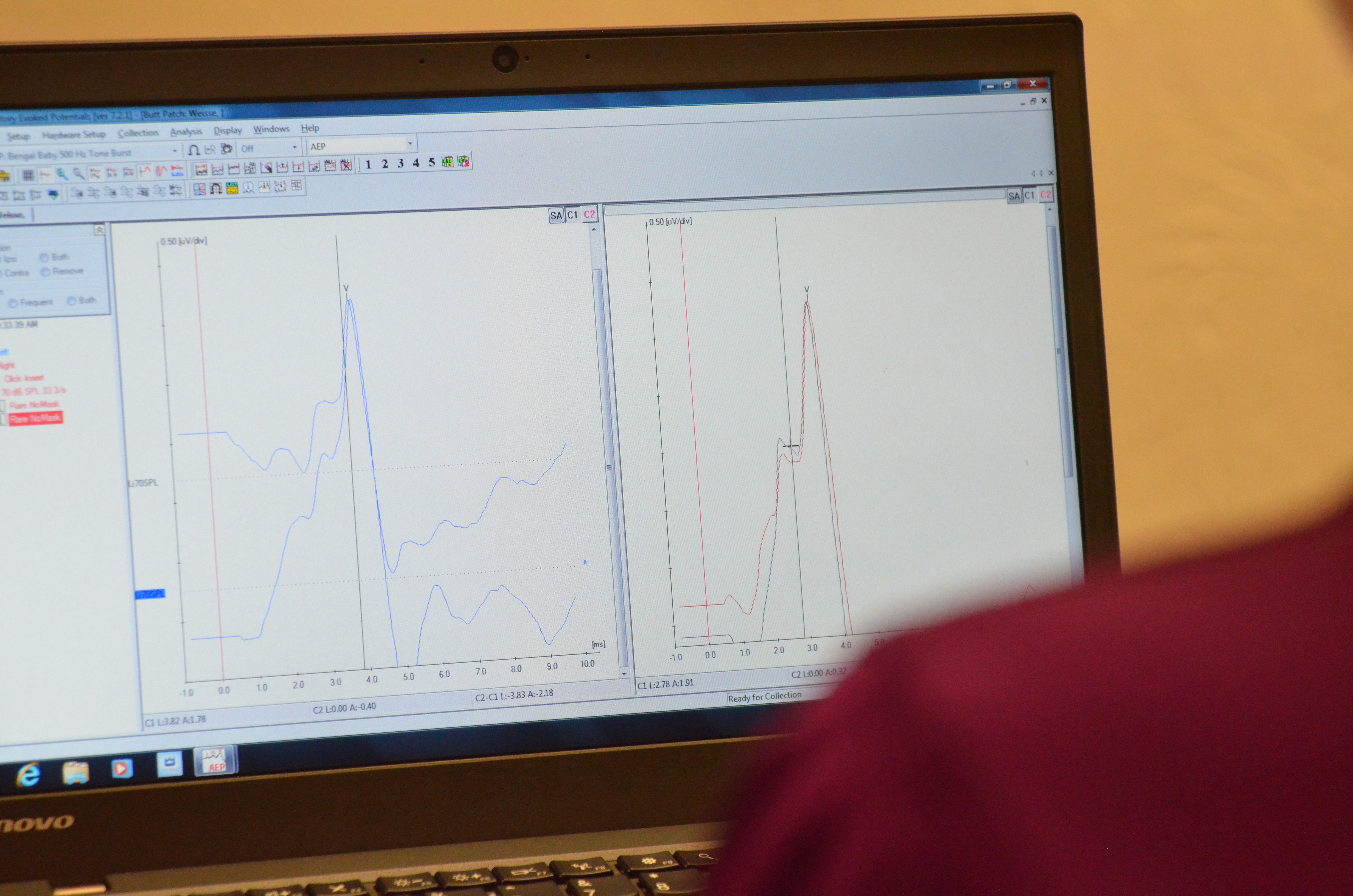 Audiologists at Idaho State screen Ryman Setters for hearing loss